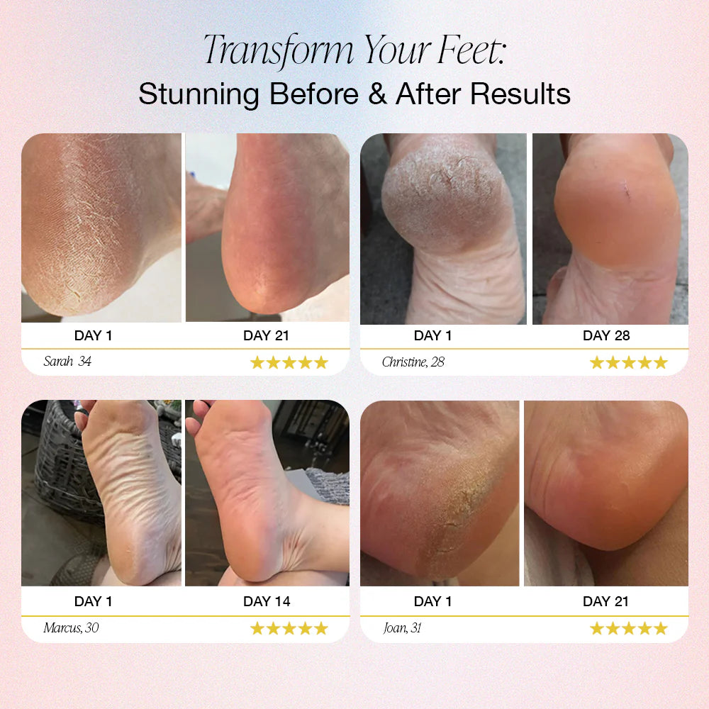 GlowSole™ Electric Foot Callus Remover